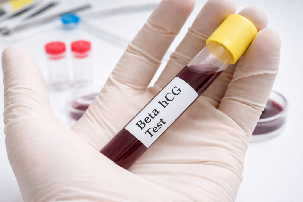 Teste de Gravidez Comprar (2)