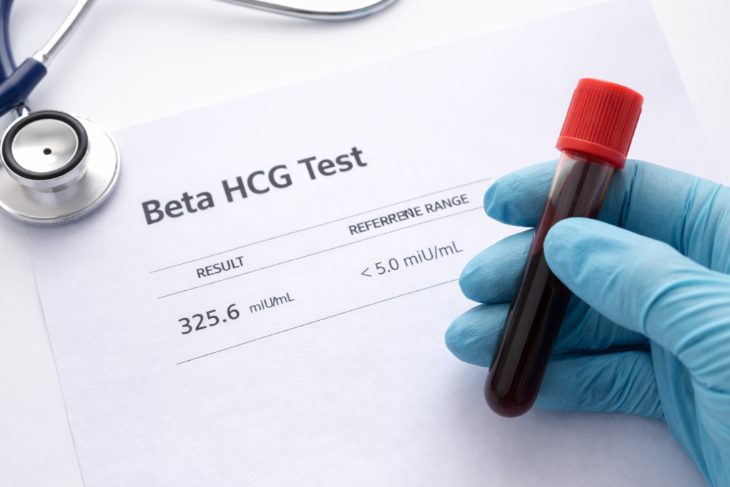 Comprar Teste de Gravidez Positivo